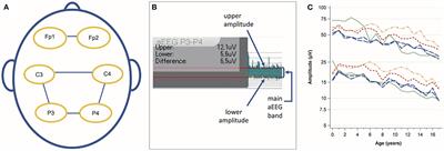 The impact of age and electrode position on amplitude-integrated EEGs in children from 1 month to 17 years of age
